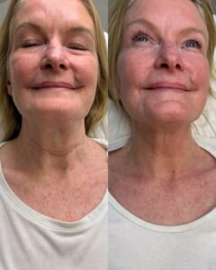 1d467b8b-d3dd-42e7-b766-f5d99711cc40