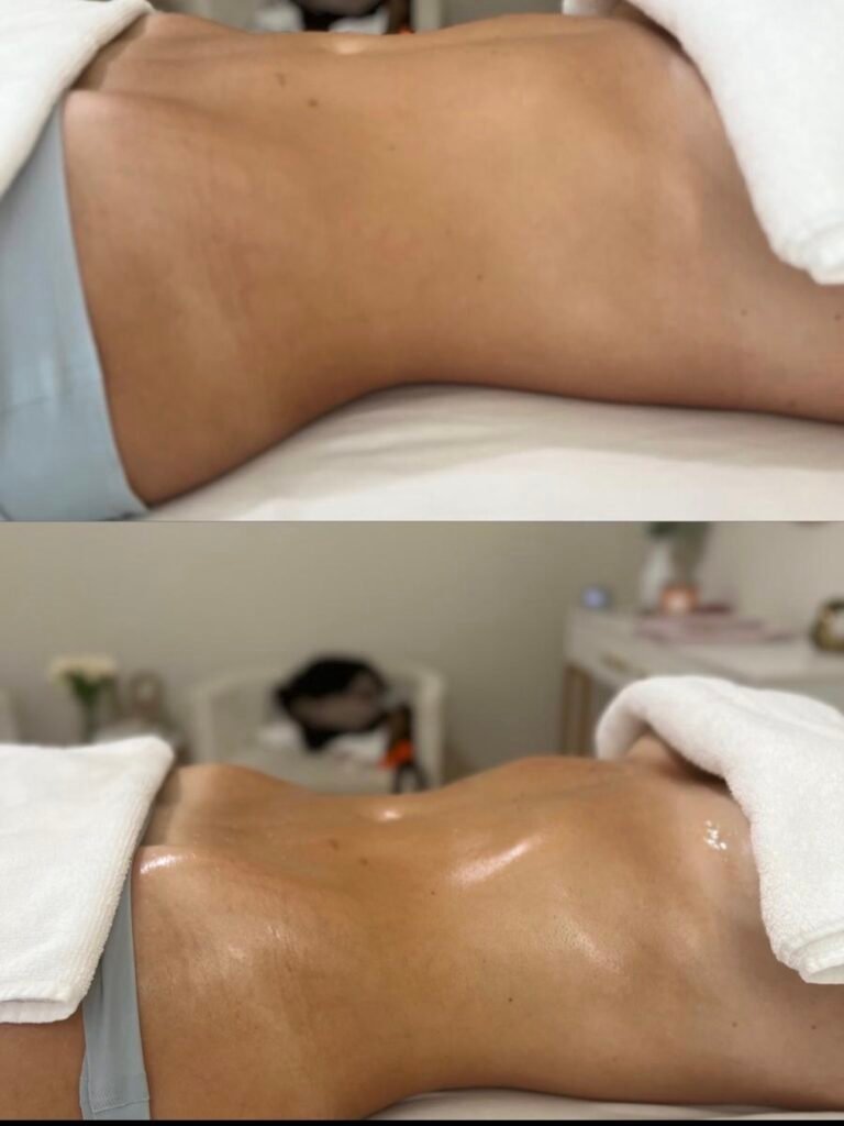 ScreenBody Sculpting Massageshot