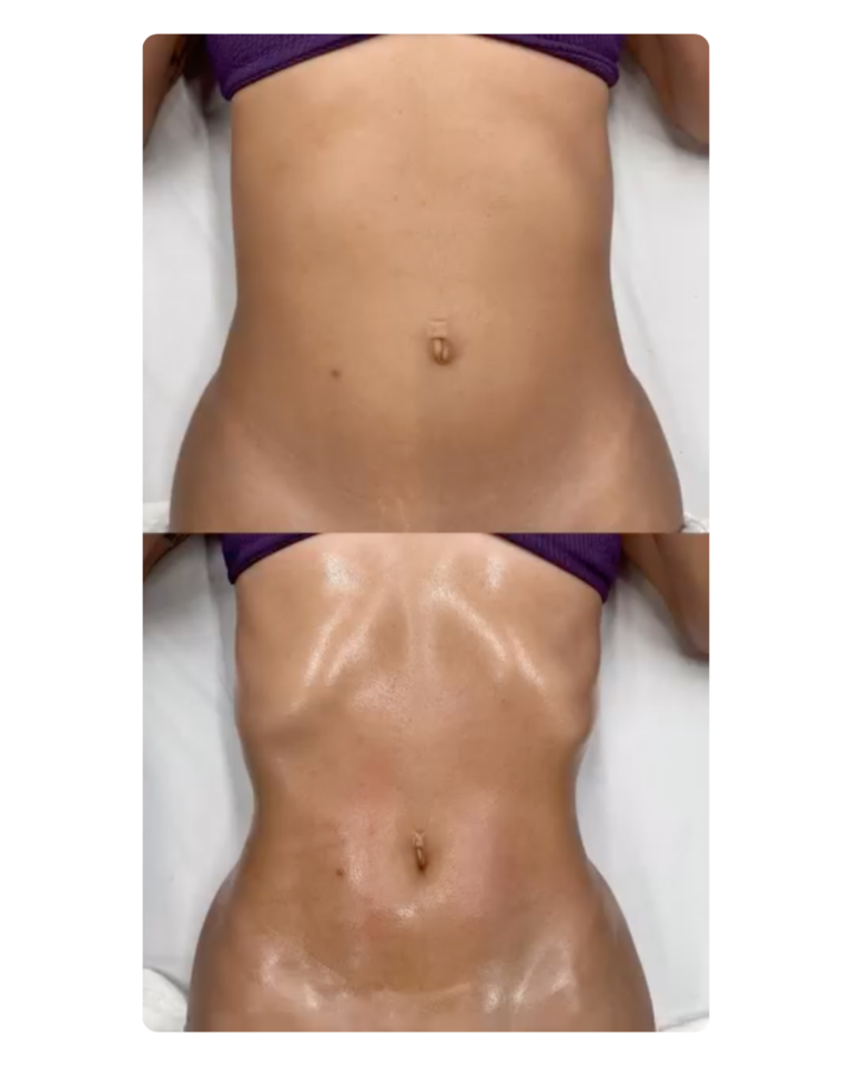 Body Sculpting Massage