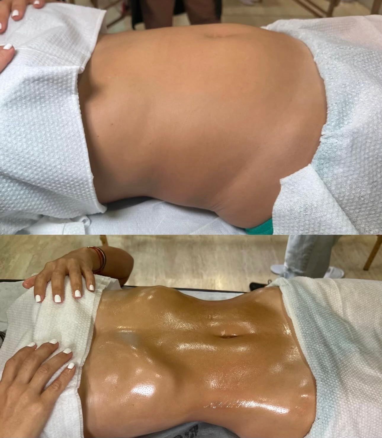 Body sculpting massage