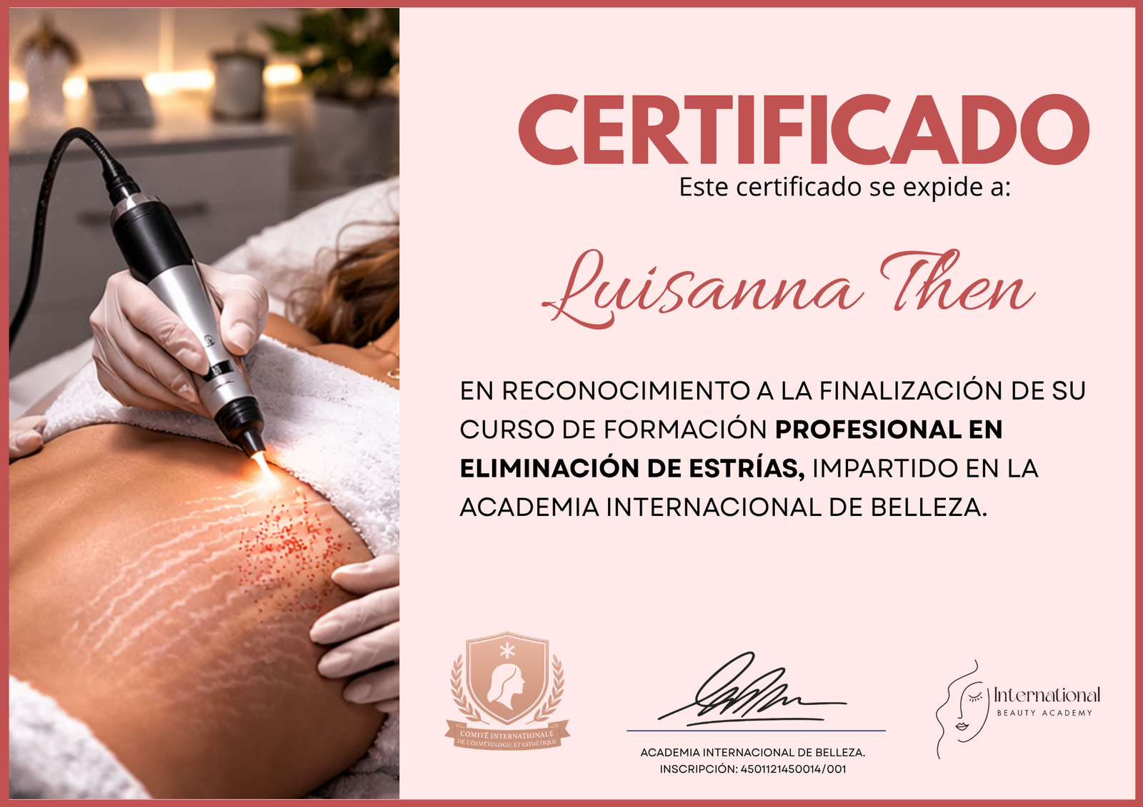 (Spanish) PLASMA PEN