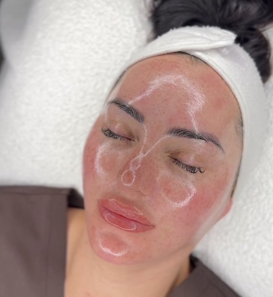 Glass skin result