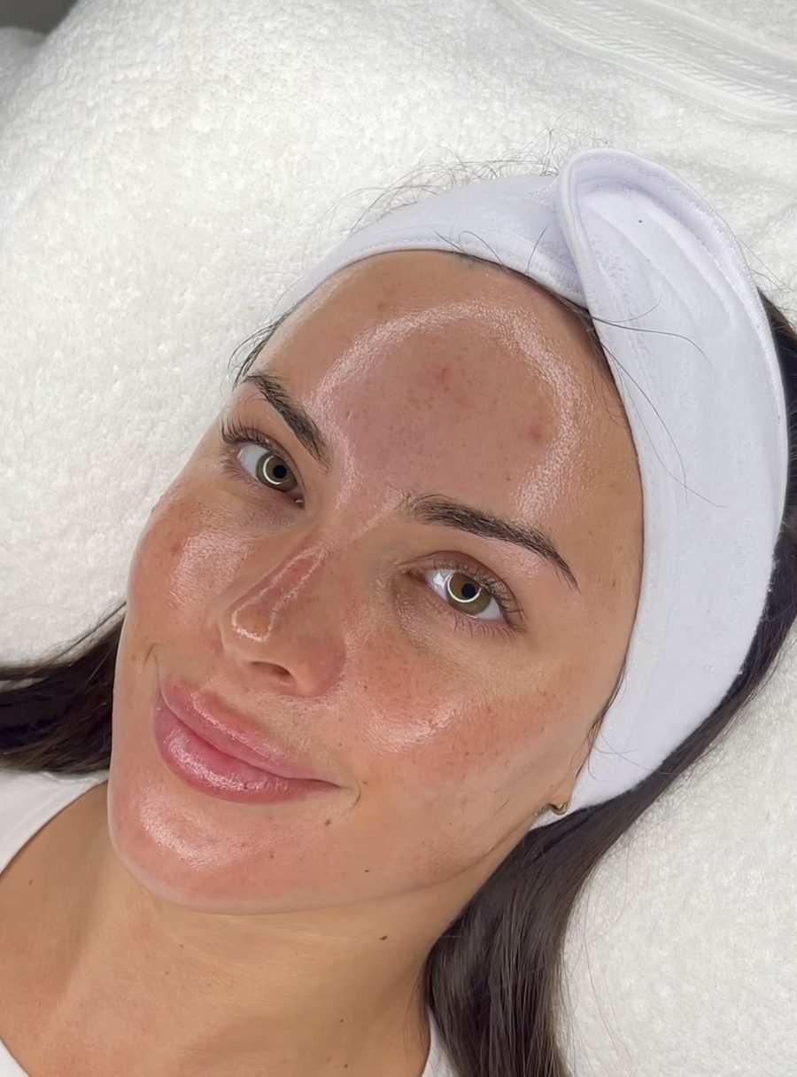 Glass skin result