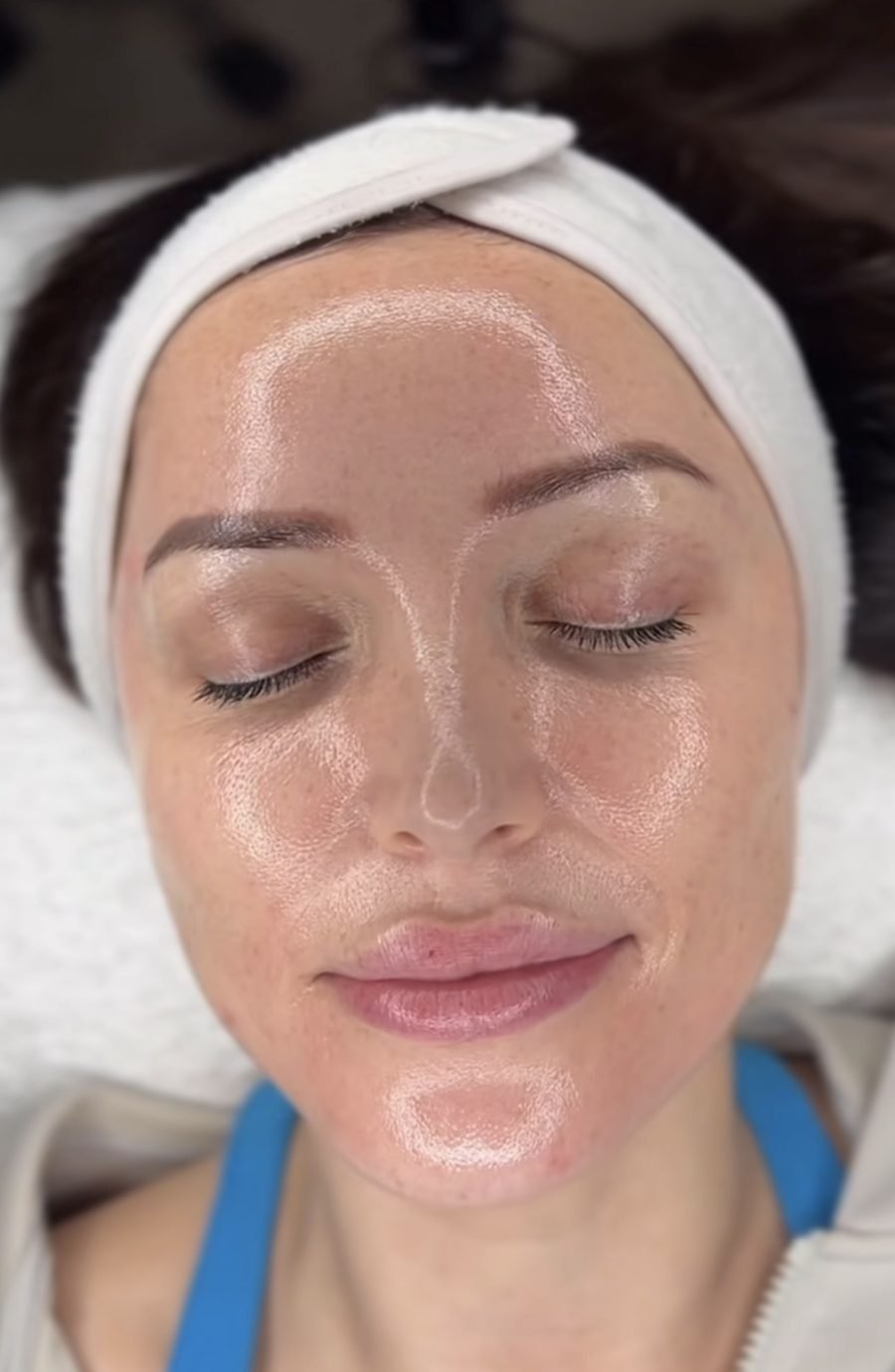 Glass skin result