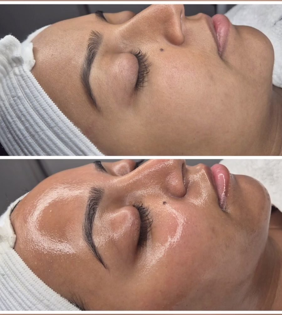 Glass skin result