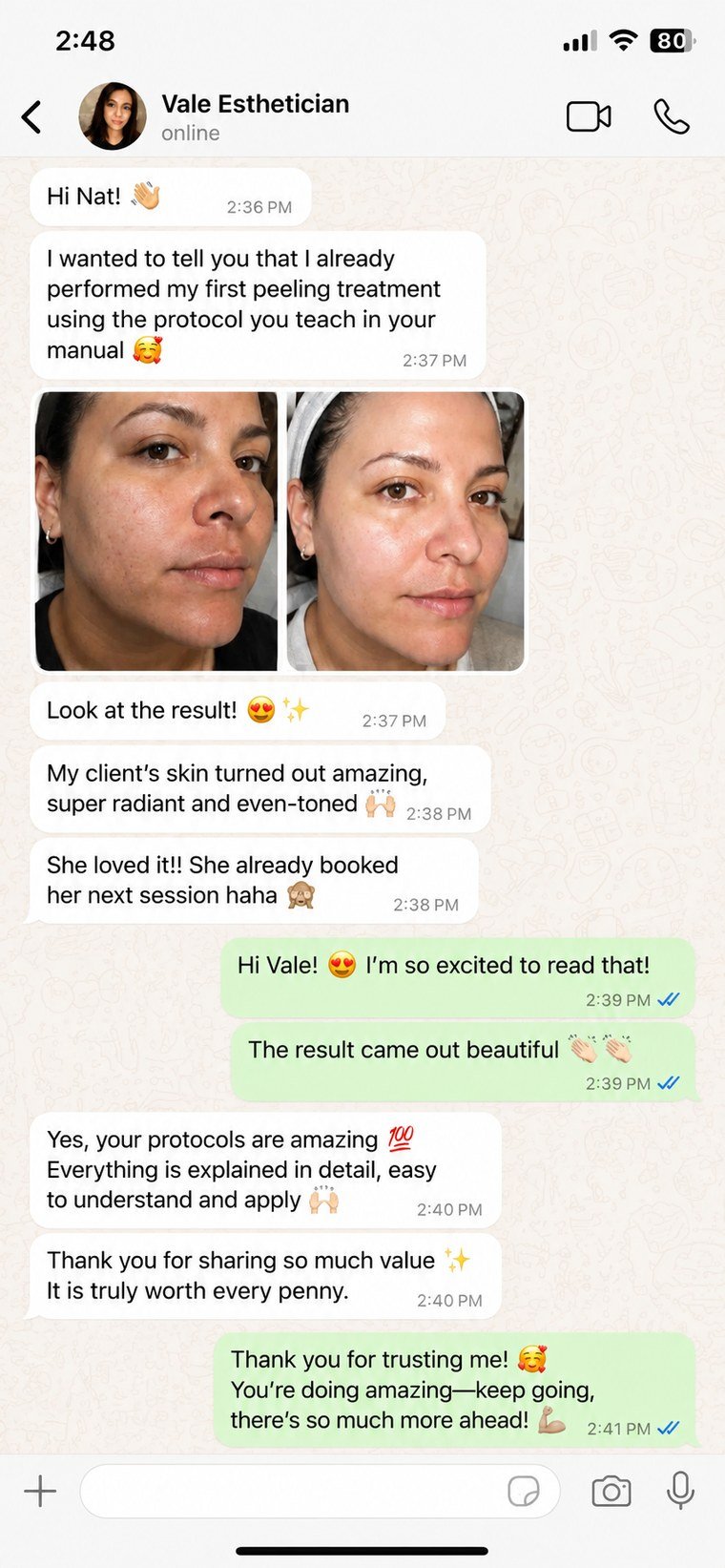 Student review — Vale, before and after